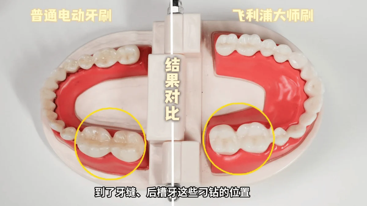 飞利浦专业声波洁牙科技:电动牙刷“功能内卷”之后,谁还在认真把牙刷干净